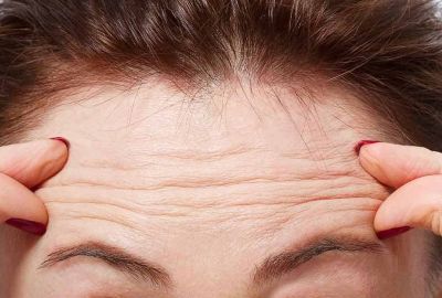 Kolajen Eksikliği Belirtileri Nelerdir?