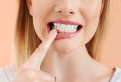 Diş Eti Çekilmesi Hangi Vitamin Eksikliğinde Olur?