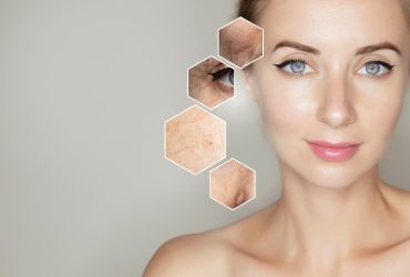 Kolajen Nedir? Faydaları Nelerdir?
