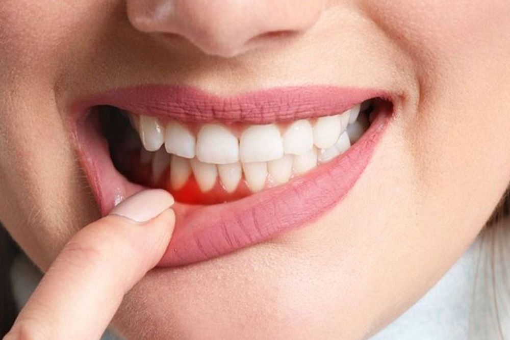 Vitamin Eksikliğinin Ağızdaki Belirtileri: Tanı ve Tedavi Yöntemleri